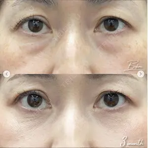 湘南美容クリニック 銀座院の症例
