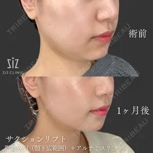 ziz CLINIC 村岡 史子医師の症例