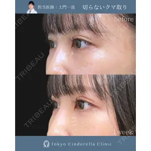東京シンデレラ美容外科 大宮院の症例