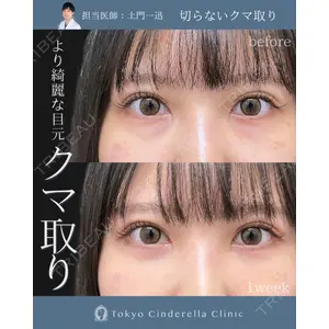 東京シンデレラ美容外科 大宮院の症例