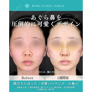 WOM CLINIC GINZA （ワム クリニック ギンザ） 中井 孝昌医師の症例