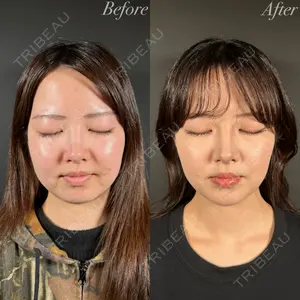 R Beauty CLINIC 名古屋院 木村 尚大医師の症例