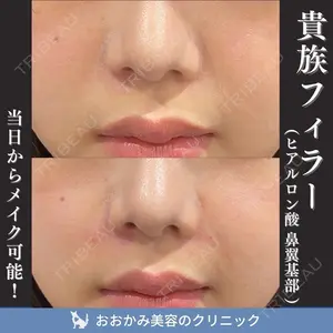 おおかみ美容のクリニック 新宿院 本郷 玲医師の症例