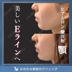 おおかみ美容のクリニック 新宿院 本郷 玲医師の症例