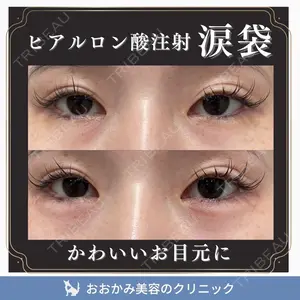 おおかみ美容のクリニック 新宿院 本郷 玲医師の症例