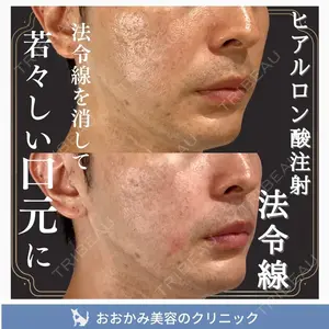 おおかみ美容のクリニック 新宿院 本郷 玲医師の症例