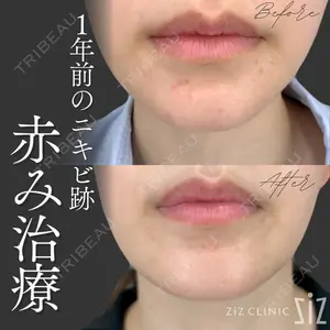 ziz CLINIC 村岡 史子医師の症例