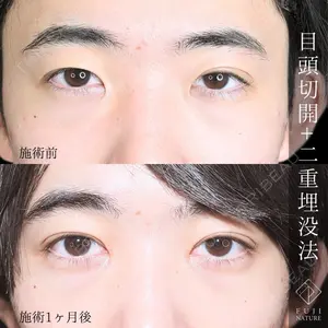 藤・ナチュレ美容クリニック 銀座院 小川 杏平医師の症例