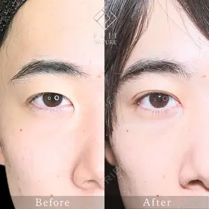 藤・ナチュレ美容クリニック 銀座院 小川 杏平医師の症例