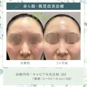 オラクル美容皮膚科 東京新宿院の症例