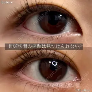 グローバルビューティークリニック 大阪院の症例