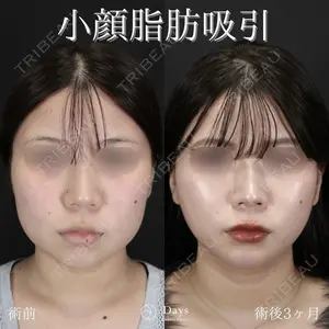 Days Beauty Clinic 山野 祐医師の症例