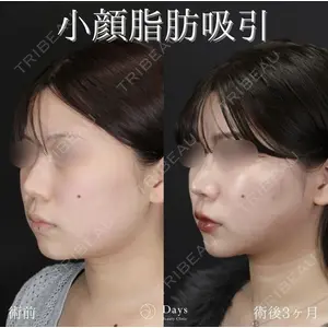 Days Beauty Clinic 山野 祐医師の症例