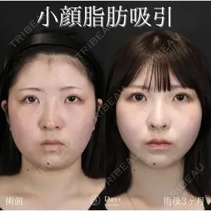 Days Beauty Clinic 山野 祐医師の症例