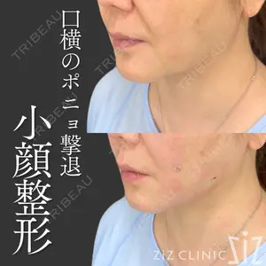 ziz CLINIC 村岡 史子医師の症例