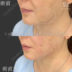 ziz CLINIC 村岡 史子医師の症例
