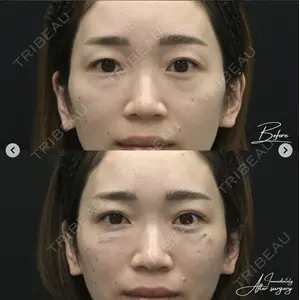湘南美容クリニック 銀座院の症例