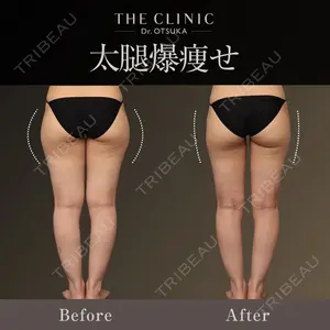 THE CLINIC（ザ・クリニック） 東京院 大塚 憲医師の症例