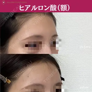 ギャラリークリニック 銀座の症例