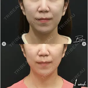 湘南美容クリニック 銀座院の症例