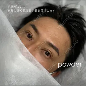 APスキンクリニック銀座の症例