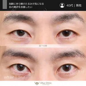 Otus Clinic 【オータスクリニック】 中 徳太郎医師の症例