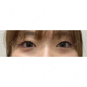 おおたかの森ビューティークリニックの症例