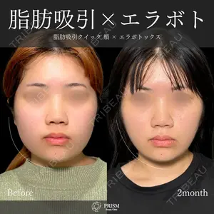 PRISM Beauty Clinic 畑山 知輝医師の症例