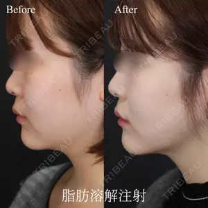 Days Beauty Clinicの症例