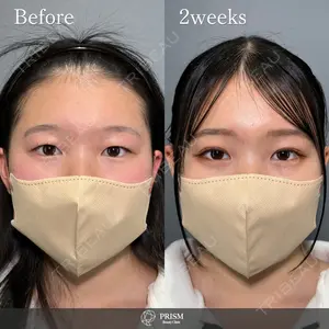 PRISM Beauty Clinic 畑山 知輝医師の症例