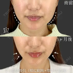 ziz CLINIC 村岡 史子医師の症例