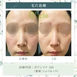 オラクル美容皮膚科 東京新宿院の症例