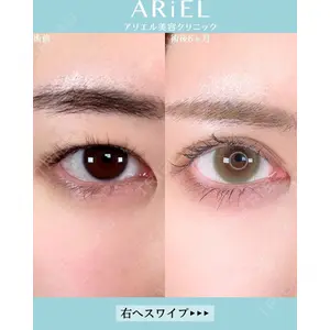 アリエル美容クリニック 大宮院 鈴木　桂介医師の症例