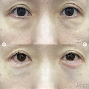 湘南美容クリニック 銀座院の症例
