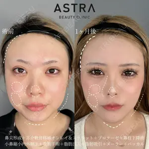 ASTRA BEAUTY CLINIC 塩満 惠子医師の症例