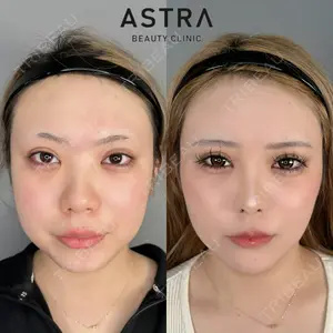 ASTRA BEAUTY CLINIC 塩満 惠子医師の症例