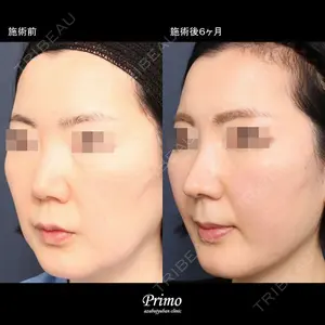 プリモ麻布十番クリニック 大場教弘医師の症例