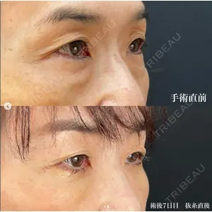 湘南美容クリニック 銀座院の症例