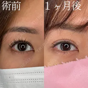 HAAB×DREAM BEAUTY CLINIC 大阪梅田院 柏木 太雅医師の症例