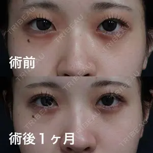 コスメディカルクリニック シンシア 銀座院 梁 淑姫医師の症例