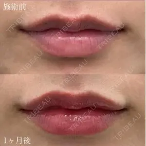 湘南美容クリニック 博多院 西川 菜穂子医師の症例
