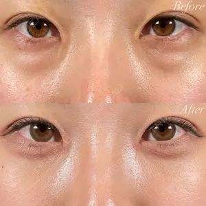 R Beauty CLINIC 名古屋院 木村 尚大医師の症例
