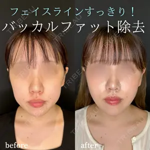 ルラ美容クリニック 名古屋本院 馬場 愛理医師の症例