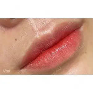 しんゆり美容健康クリニックの症例