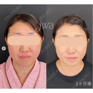自由が丘ウェルエイジングビューティークリニック 福田 知佐子医師の症例
