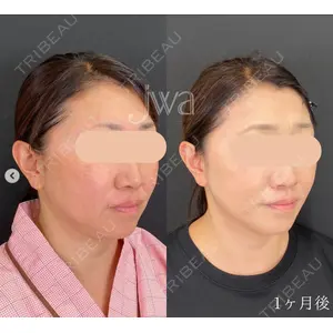 自由が丘ウェルエイジングビューティークリニック 福田 知佐子医師の症例