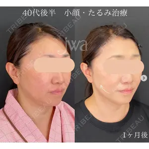 自由が丘ウェルエイジングビューティークリニック 福田 知佐子医師の症例