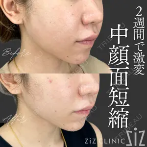 ziz CLINIC 村岡 史子医師の症例
