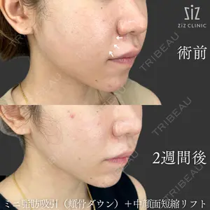 ziz CLINIC 村岡 史子医師の症例
