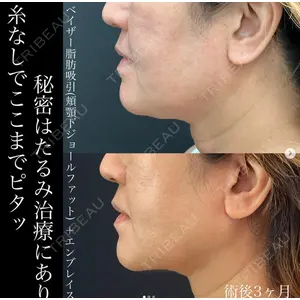 湘南美容クリニック 名古屋駅本院 豊嶋 沙良医師の症例